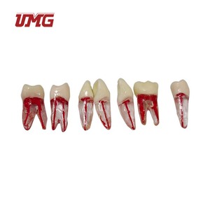 Simulatore Dentale per Pratica di Esame Odontoiatrico: Denti con Canale Radicolare e Cavità Pulpare Riempita in Resina - Product Image 3