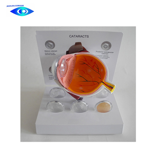 Modelo de ojo humano de catarraco para ciencia médica, modelo de ojo anatómica - Product Image 2