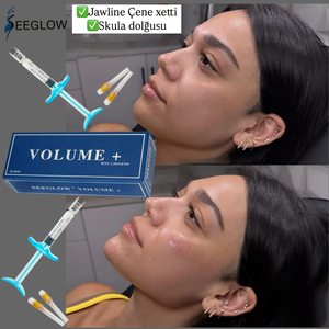 SEEGLOW Ha Gel Iniettabile Reticolato Anti-Età e Sbiancante per Viso, Linea Mascellare, Guance, Mento, Naso, Occhi, Labbra - Filler Dermico all'<span class=keywords><strong>Acido</strong></span> <span class=keywords><strong>Ialuronico</strong></span> - Product Image 2