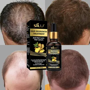Neopel max-aceite de jengibre para el crecimiento del cabello, loción para rejuvenecimiento del cabello, tonifica, 7 días