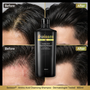Shampooing Volumisant et Séborégulateur à Base d'Acides Aminés <span class=keywords><strong>pour</strong></span> Hommes – Produits Capillaires OEM en Gros <span class=keywords><strong>pour</strong></span> Salons et Centres de Fitness – Sans Sulfate et Sans Parabène - Product Image 2