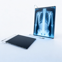Détecteur de rayons X numérique portable 14×17 17×17 DR, panneau d'imagerie radiographique numérique pour hôpital, clinique et système de radiographie mobile