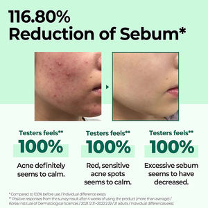 Anti acné <span class=keywords><strong>boutons</strong></span> taches sombres acide hyaluronique hydratant éclaircissant rétrécissement pores collagène vitamine C blanchissant visage toner - Product Image 4