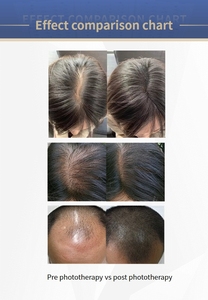 Máquina Multifuncional 7 en 1 para el Cuidado del Cuero Cabelludo, Esterilización con Plasma, Microcorriente <span class=keywords><strong>BIO</strong></span>, Masaje del Cuero Cabelludo, Anticaída del Cabello, Nutritiva, Comercial - Product Image 4