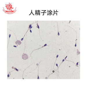 Équipement pédagogique biologique pour l'analyse des écouvillons de sperme humain, microscopie préliminaire, démonstration, lamelles microscopiques, sections biologiques - Product Image 4