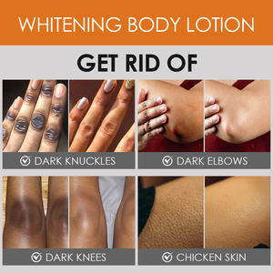Lotion corporelle éclaircissante <span class=keywords><strong>et</strong></span> nourrissante à base <span class=keywords><strong>de</strong></span> plantes antioxydante pour la peau avec vitamine E pour améliorer le teint irrégulier <span class=keywords><strong>de</strong></span> la peau - Product Image 2