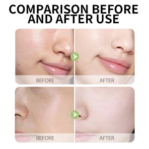 OEM Factoey Customized Private logo Facial Skin Care Niacinamide <b>Face</b> <b>Serum</b> for All Skin Types - Product Image 6