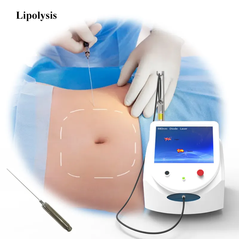 980nm Diode Laser for Lipolysis, facelift, vascular removal hemorrhoid treatment, PLDD, ENT, Physiotherapy Fungal Nail Removal