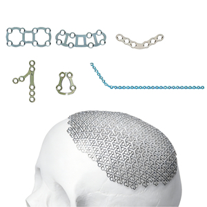 Cadre de reconstruction du visage médial (<span class=keywords><strong>Le</strong></span> Fort) en titane imprimé en 3D sur mesure - Product Image 3