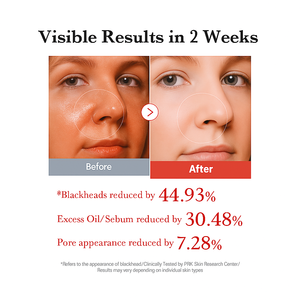 แผ่นโทนเนอร์บำรุงผิวหน้าเกาหลี ผสมกรดแลคติก 4.5% และกรดซาลิไซลิก 0.45% พร้อมแผ่นซับรูขุมขน - Product Image 5