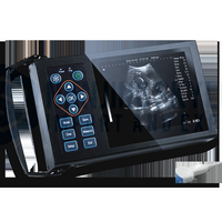 جهاز مسح بالموجات فوق الصوتية محمول للطب البيطري لفحص حمل الأغنام والخنازير - Product Image 4