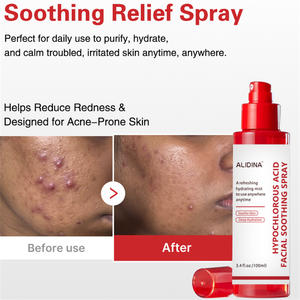 <span class=keywords><strong>Spray</strong></span> Purifiant à l'Acide Hypochloreux GZ contre l'Acné |   Brume hydratante intense et réparatrice de la barrière cutanée - Product Image 4