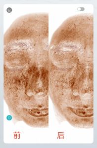 Analizador de Piel Inteligente con IA de Grado Industrial HD de Diez Espectros y 20 Indicadores, Máquina de Diagnóstico para Salón de Belleza - Product Image 5