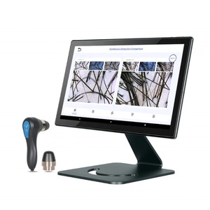 Máquina Analizadora de Piel Inteligente con IA Litian LT-FD008 con Ampliación de 200x para Folículos Capilares, WiFi/Bluetooth para Uso Clínico y Doméstico - Product Image 3