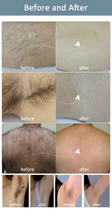 Glace de 15.6 pouces refroidissant la machine permanente d'épilation de laser de diode indolore de 755 808 1064nm - Product Image 6