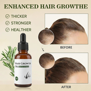 Best seller 10ml di <span class=keywords><strong>olio</strong></span> essenziale biologico di marca privata per una crescita rapida ed efficace delle sopracciglia delle ciglia dei capelli - Product Image 3