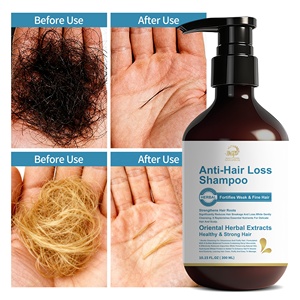 Shampooing anti-chute bio 300ml pour fortifier les cheveux faibles et fins, améliorer la santé du cuir chevelu et renforcer les racines des cheveux - Product Image 2