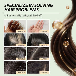 Shampooing assombrissant pour <span class=keywords><strong>cheveux</strong></span> R Natural Polygonum, <span class=keywords><strong>cheveux</strong></span> noirs et épais, shampooing en barre à l'extrait de Fallopia multiflora, shampooing à l'extrait de He Shou Wu - Product Image 4