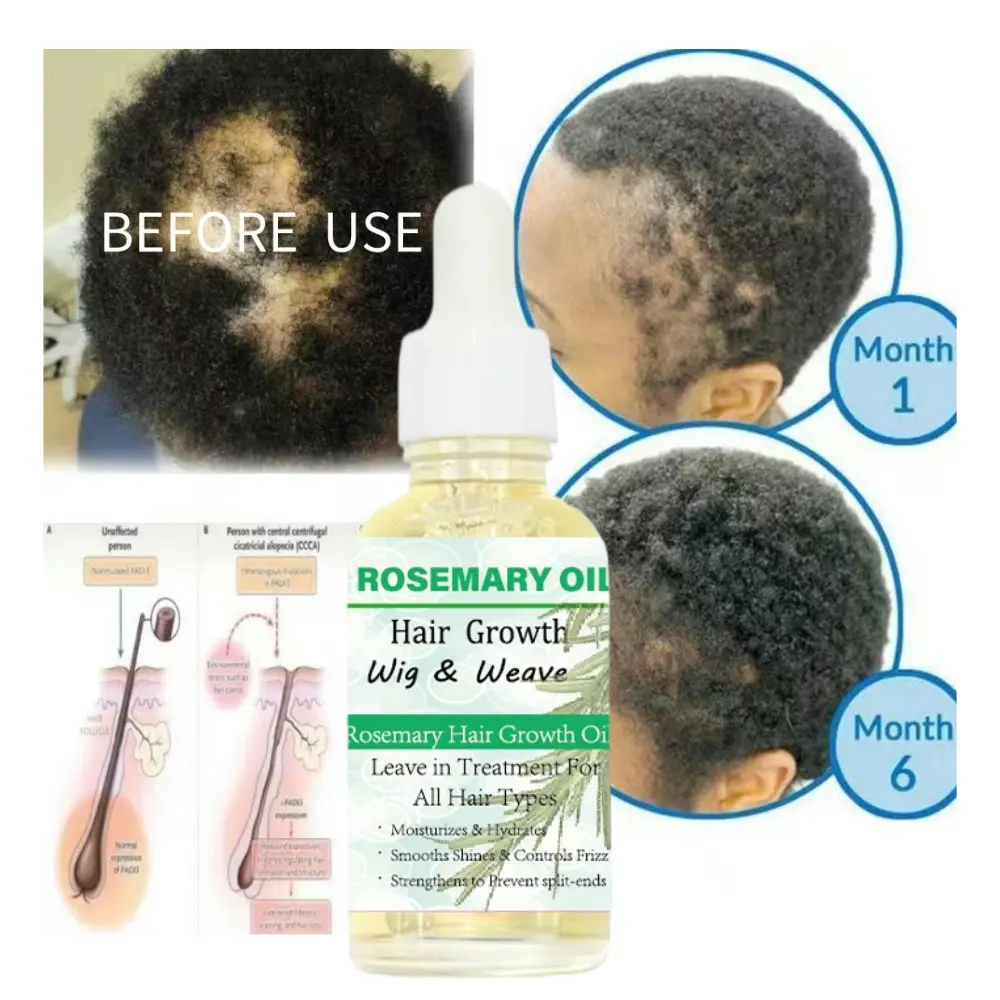 Private Label Premium Argan Oil Nature Smoothing Hair Growth Oil Vitamins E Hair Essential Oil