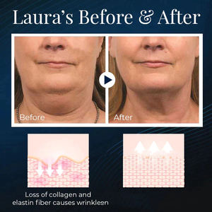 Dinamoelektrik cerdas terbaru penghenti dengkuran pintar tenang efektif perangkat antidengkur grosir tidur lebih baik elektrik - Product Image 5