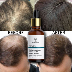 Aceite <span class=keywords><strong>de</strong></span> Tratamiento Capilar Natural <span class=keywords><strong>de</strong></span> Tailandia, Suero para el <span class=keywords><strong>Crecimiento</strong></span> del Cabello con Biotina y Múltiples Péptidos Ordinarios Anticaída - Product Image 1