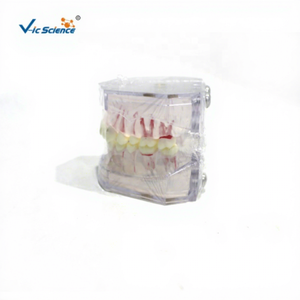 Modèle dentaire standard blanc complet avec arrangement et occlusion dentaires réalistes - Product Image 1