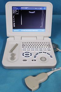 Scanner portatif d'ultrason avec l'imagerie à haute résolution, conception légère pour le diagnostic médical - Product Image 6