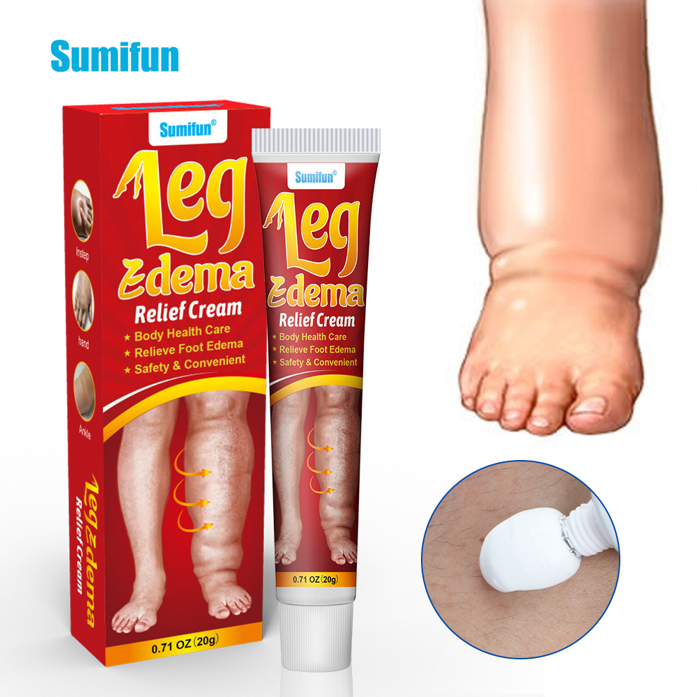 Hight Quality Ointment for Leg Edema Muscle Swelling Soothing Massage Healthcare Supply Cross-Border Foreign Trade