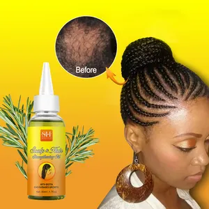 Private Label Natural Scalp Care Oil Hidratar Scalp Promover o óleo de crescimento do cabelo Tranças Anti-coceira Hair Oil