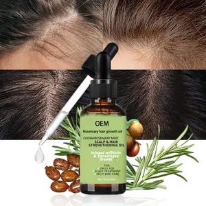 מותג פרטי טבעי אורגני רוזמרין חיוני שמן נשים שחור שיער טיפול מוצר רוזמרין קוקוס צמיחת שיער שמן