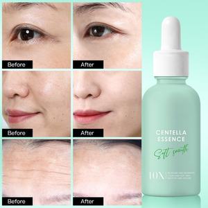Suero Reparador de Centella Asiática para el Cuidado de la Piel Coreano, Esencia Revitalizante, Suero Facial para Maquillaje - Product Image 5