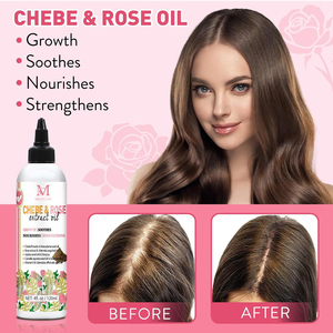 OEM Custom Herbs Herbal Natural Biotin Nourishing Regrowth <strong>Oils</strong> Rapid Rosemary <strong>Oil</strong> for Hair Growth Products Private Label - Product Image 4