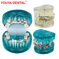YOUYA DENTAL Nouveau Modèle Anatomique d'Orthodontie Dentaire pour l'Enseignement en Sciences Médicales, avec Supports Dentaires Standard en Résine, 2 Couleurs TM-212-A/B