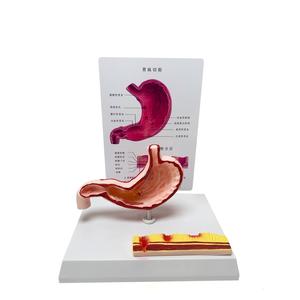 แบบจำลองกายวิภาคกระเพาะอาหารมนุษย์พร้อมโรคภูมิภาคนิยมพบกัน ตัดตามยาว สำหรับ<span class=keywords><strong>การ</strong></span>สอนทาง<span class=keywords><strong>การ</strong></span>แพทย์ - Product Image 4