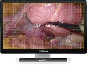 ระบบกล้องเอ็นโดสโคป Mindray UX5 ซีรีส์ 4K&NIR/4K&3D กล้อง Full HD สำหรับระบบตรวจหู คอ จมูก และสัตว์ - Product Image 5
