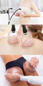 Appareil de massage colombien de haute qualité pour l'augmentation mammaire avec ventouses - Product Image 6