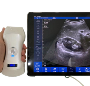 MC26 Super clear <strong>Image</strong> 3 in 1 Wireless Ultrasound Probe with 192 Elements and Convex, <strong>Linear</strong>, Cardiac Function - Product Image 1
