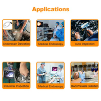 Module de caméra endoscopique à mise au point fixe 2MP, capteur numérique avec processeur d'image OEM BF20A6, protocole UVC, USB 2.0 haute vitesse, 30fps