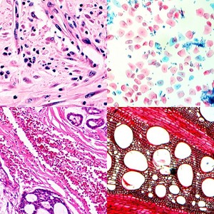 <span class=keywords><strong>Microscope</strong></span> <span class=keywords><strong>optique</strong></span> biologique binoculaire pour laboratoire hospitalier - Product Image 3