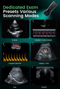 Periodmed Ultrasound Scanner Medical Handheld Handheld Portable Ultrasound Device Ultrasound <strong>Probe</strong> Wireless - Product Image 5