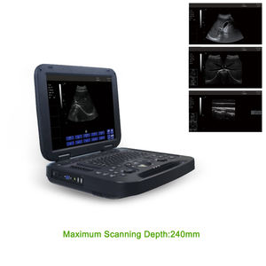 Mesin <span class=keywords><strong>Ultrasound</strong></span> portabel, instrumen medis elektrik eektrografi ecografo portabilitas dokter hewan ultrasonido - Product Image 4