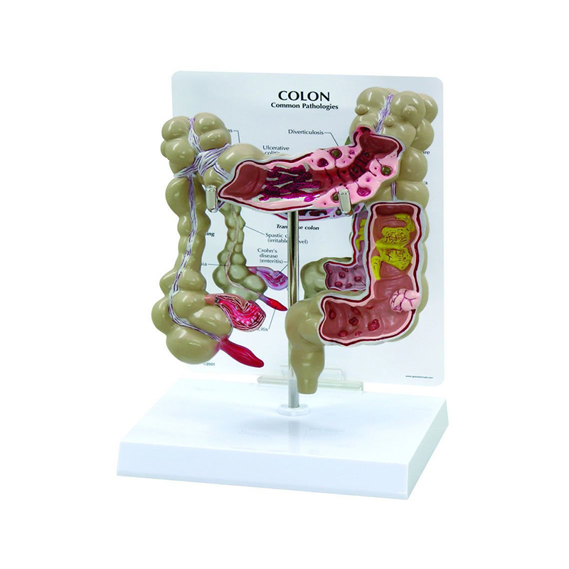 Медицинское обучение использованная модель человека патологии по анатомии человека