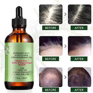 Aceite de suero de <span class=keywords><strong>Romero</strong></span> orgánico de alta calidad OEM <span class=keywords><strong>y</strong></span> ODM, aceite esencial personalizado para el cuidado del cabello a base de hierbas para el crecimiento del cabello, nutritivo <span class=keywords><strong>y</strong></span> natural - Product Image 1