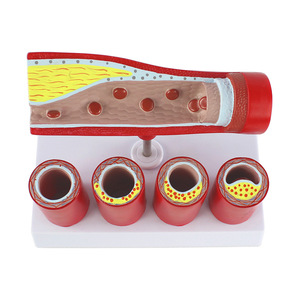 Mô hình mạch máu của con người mô hình bệnh lý động mạch vành động mạch và mạch máu - Product Image 2
