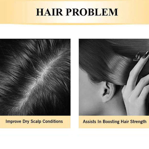 แชมพูขิงออร์แกนิคสำหรับเร่งผมยาว ลดรังแค และบำรุงเส้นผมให้เข้มข้น - Product Image 4