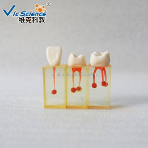 Levensgroot medisch onderwijsmodel van tanden, anatomisch model met kronen, voor tandheelkundig gebruik, menselijk oraal implantaat, tandheelkundig onderwijsmodel - Product Image 3