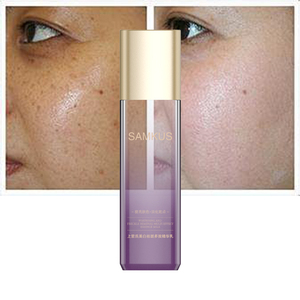 Lait d'essence multi-effets éclaircissant et anti-taches OEM/ODM pour le <span class=keywords><strong>soin</strong></span> du <span class=keywords><strong>visage</strong></span> féminin, éclaircissant et anti-imperfections - Product Image 5
