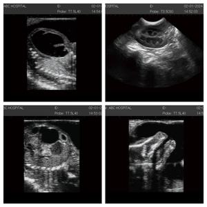 Resolusi Tinggi Tinggi terpasang 3D 4D warna <span class=keywords><strong>Doppler</strong></span> 15 inci Ecografo portatel PW <span class=keywords><strong>CW</strong></span> jantung gema mesin Ultrasound - Product Image 4