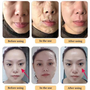 ZS <span class=keywords><strong>Miracle</strong></span> masque enzymatique de levage du visage anti-âge lifting du visage raffermissant V façonnage visage Anti-rides sorcière masque de sculpture du visage - Product Image 6