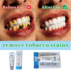 <span class=keywords><strong>Dentifricio</strong></span> alle Erbe Jianmin <span class=keywords><strong>Sensodyne</strong></span> 100g per Denti Sensibili, Sollievo Rapido da Sensibilità al Caldo/Freddo, Aiuta a Ristabilire lo Smalto, Lunga Durata - Product Image 1